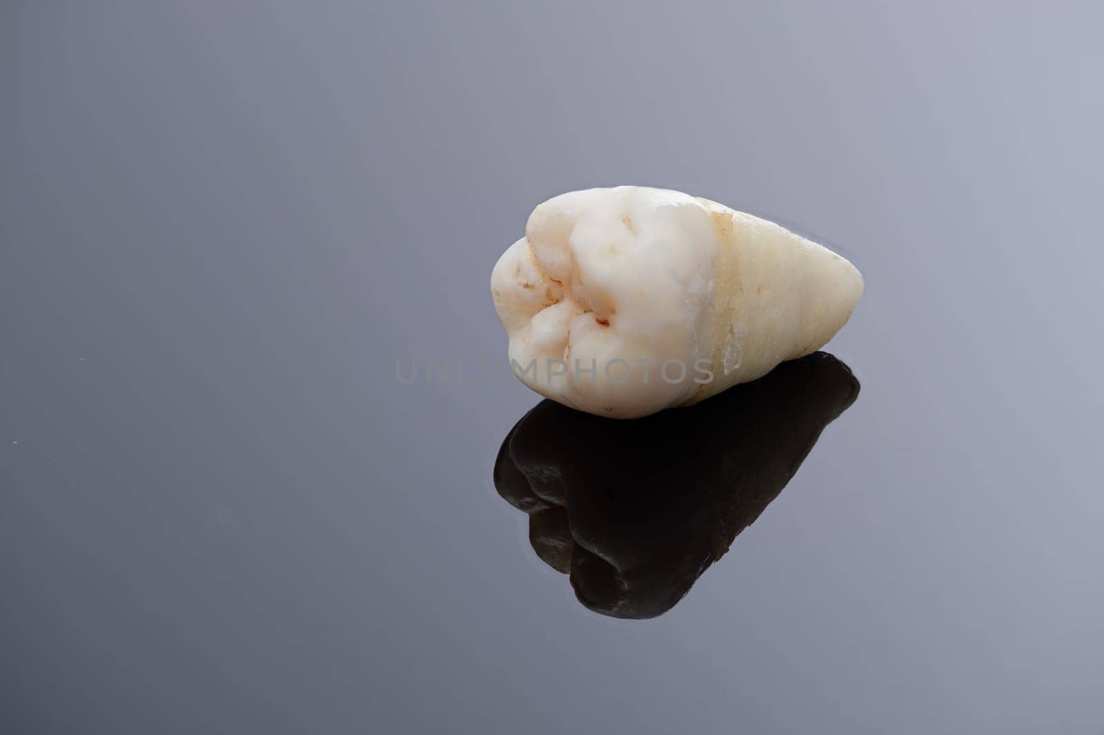 Pulled wisdom tooth on black close-up