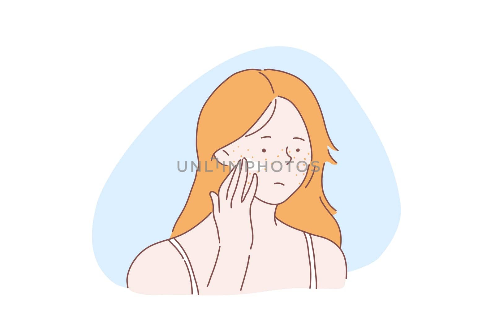 Teenage girl skincare problem concept. Woman with facial rash, lady applies cream, ointment on skin with acne pimples, covers freckles with foundation base, concealer. Simple flat vector