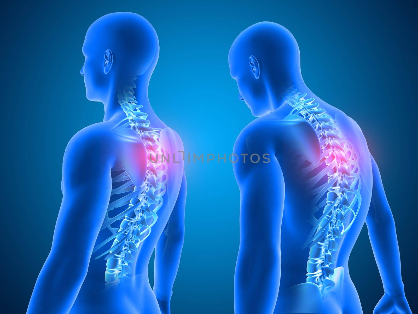 3D render of a Medical background showing good and poor posture with spine highlighted