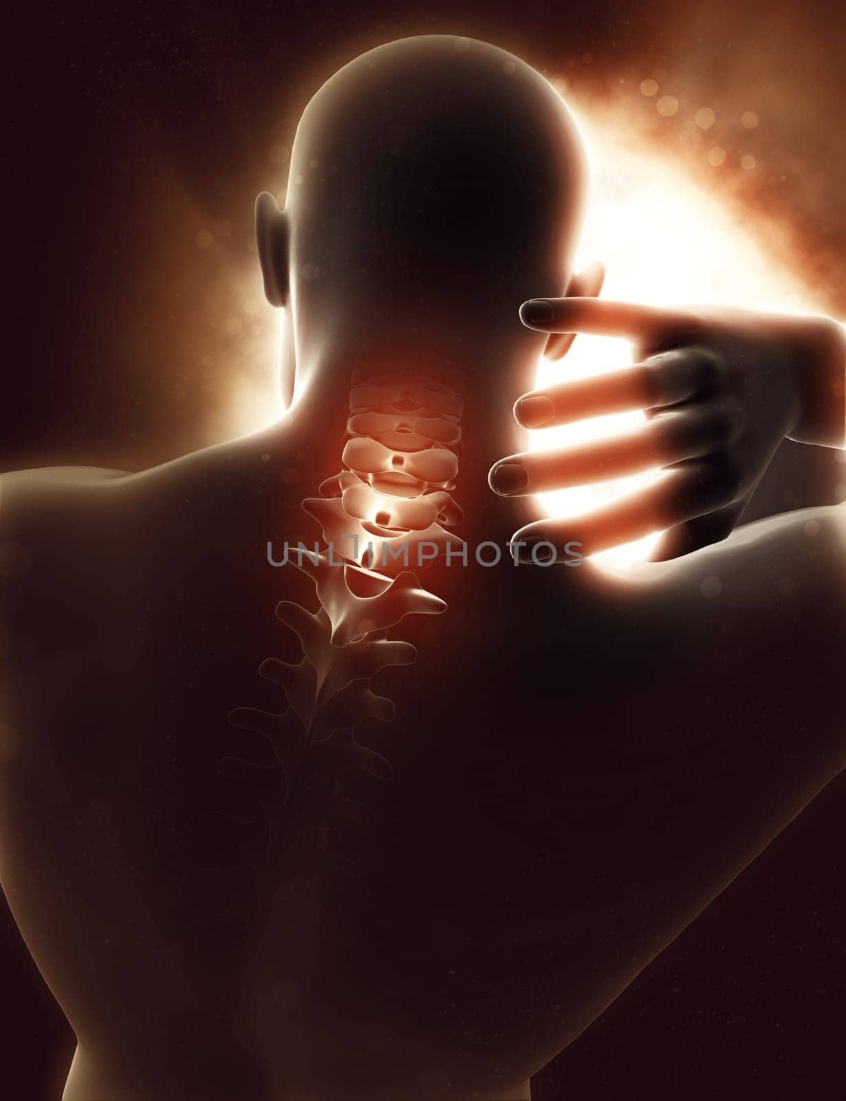 3D render of a male figure with neck highlighted in pain