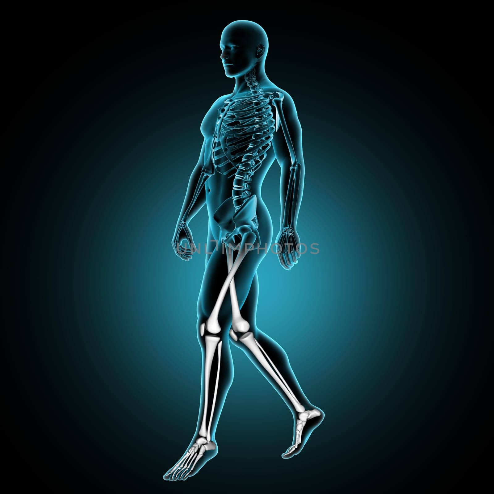 3D render of a male medical figure walking with leg bones highlighted