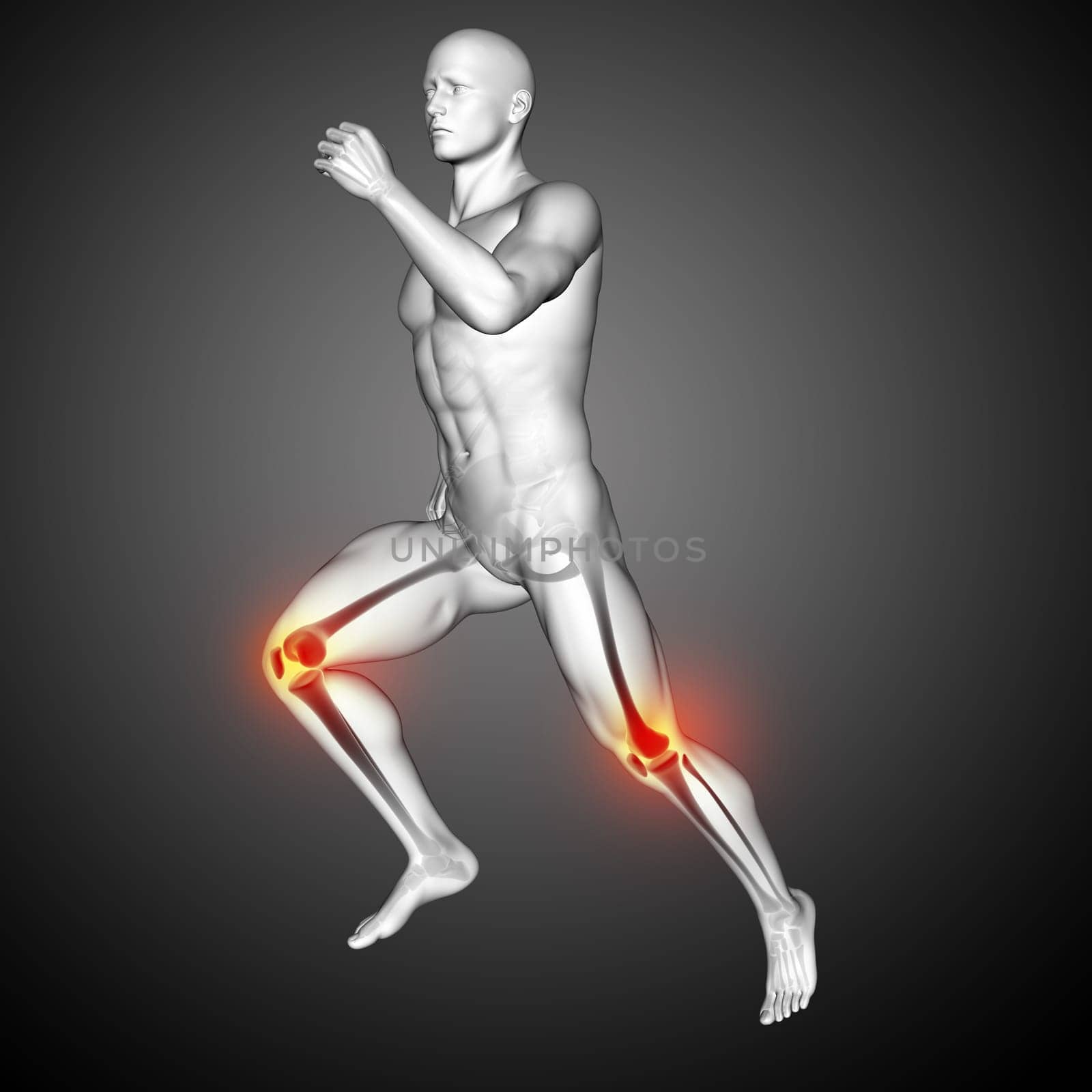 3D render of a male medical figure running with knees highlighted