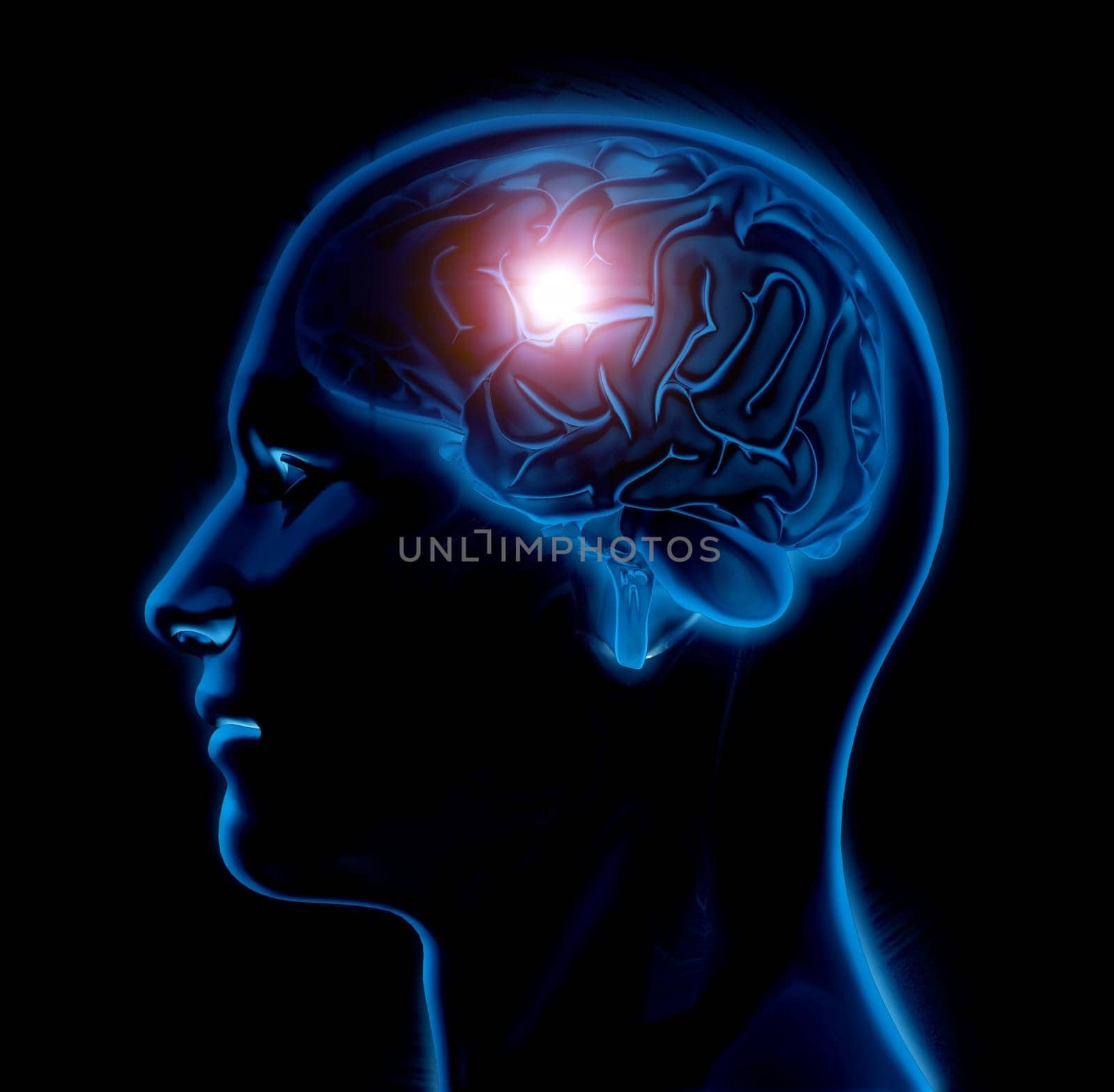 3D render of a male medical figure with brain highlighted