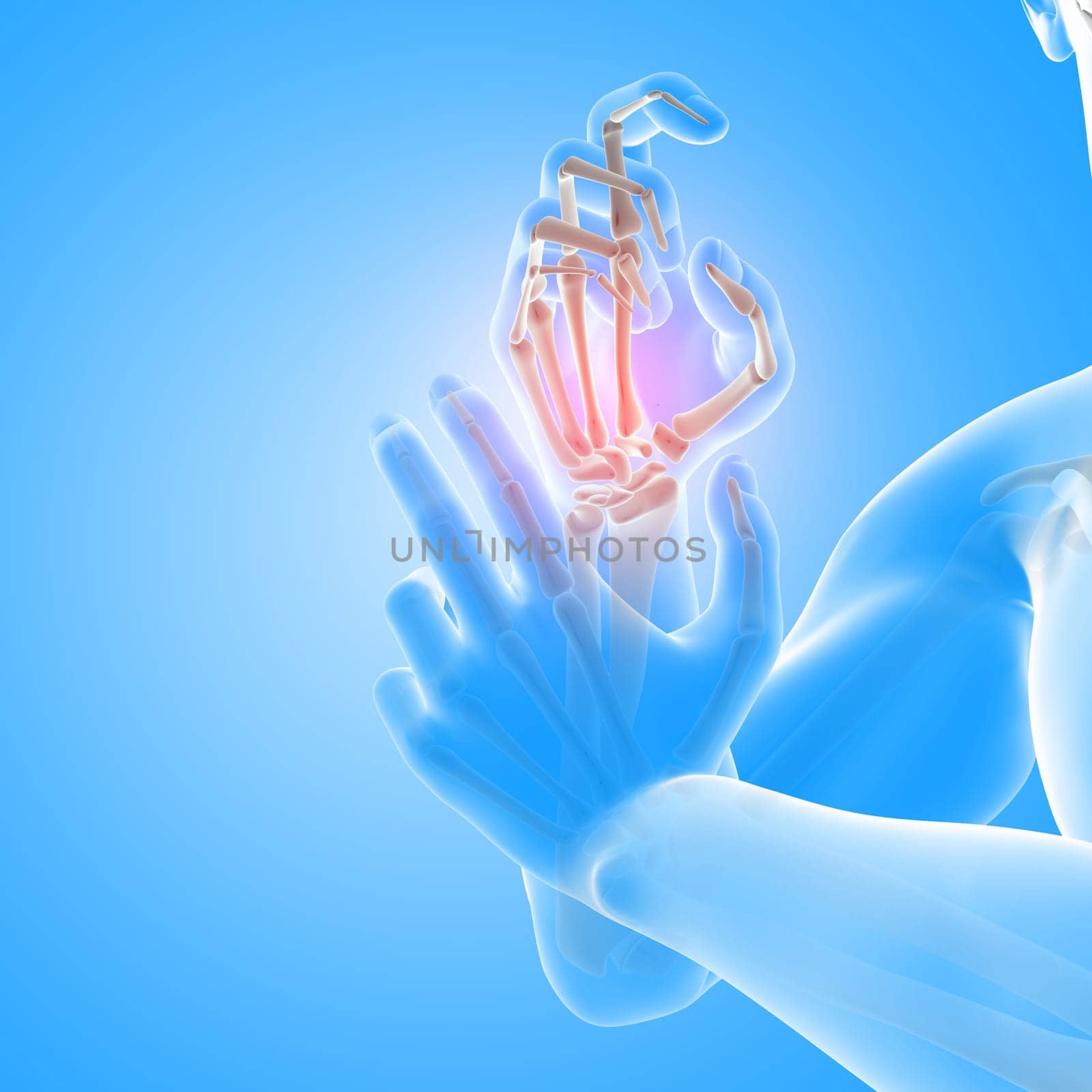 3D render of a male medical figure with close up of hand bones