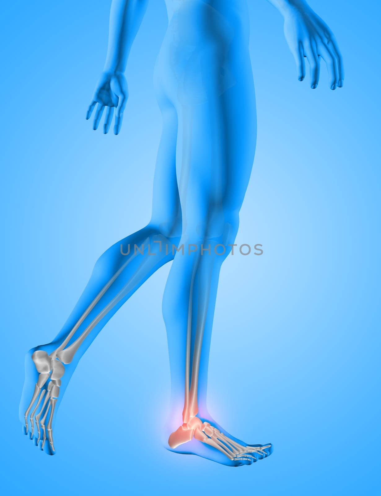 3D render of a male medical figure with feet bones highlighted