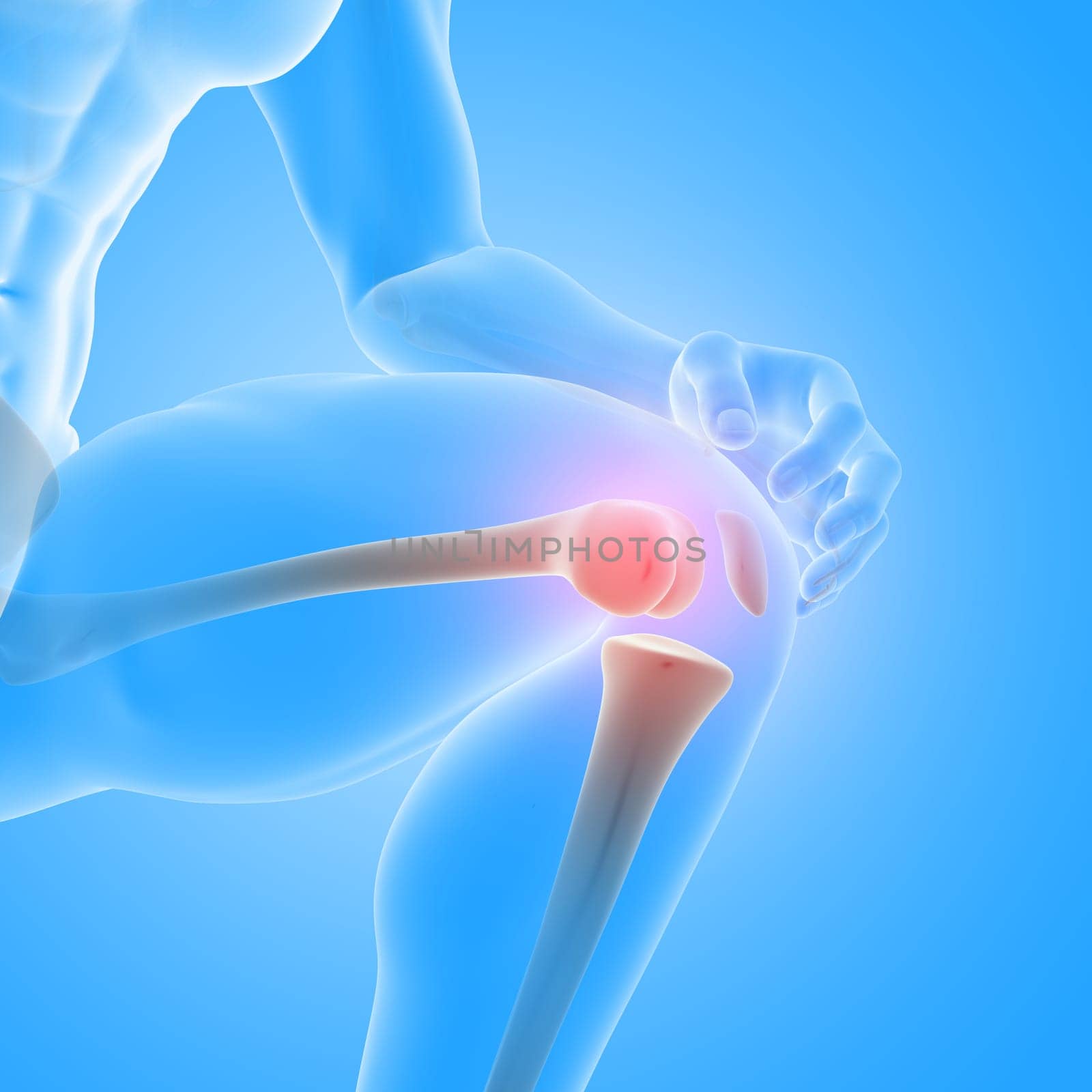 3D render of a male medical figure with close up of knee bones