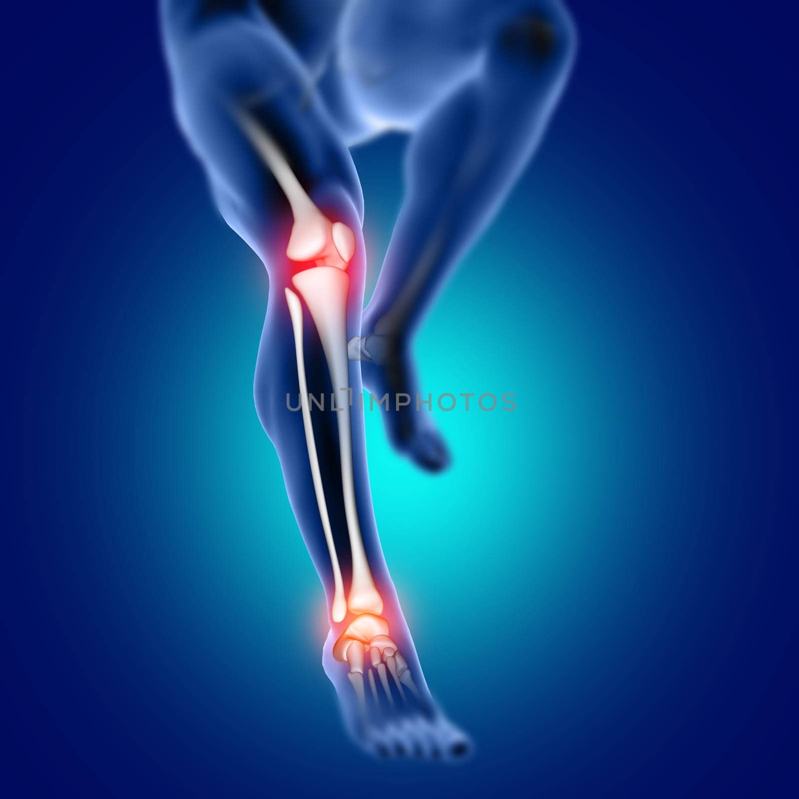 3D render of a male medical figure with knee and ankle bone highlighted