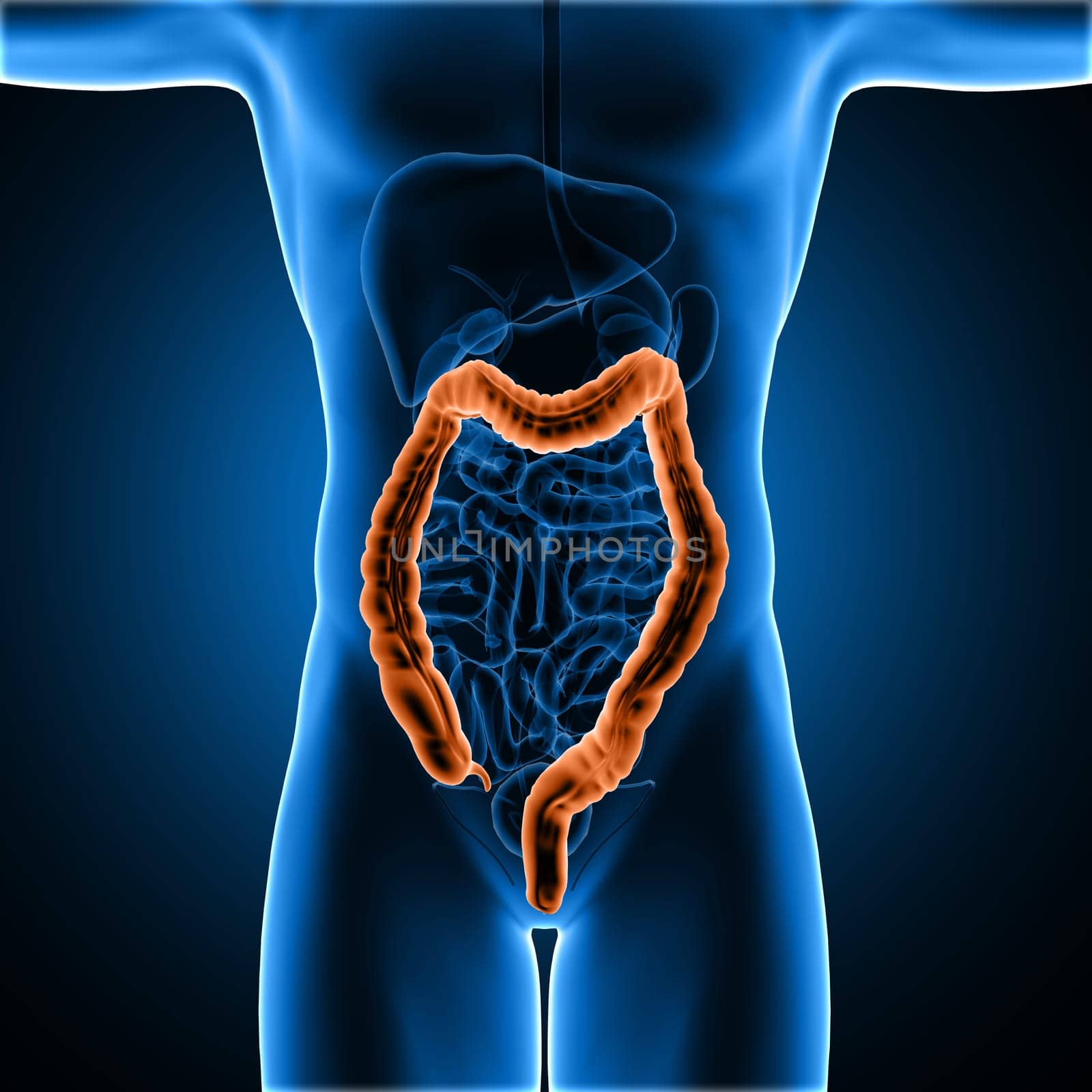 3D render of a male medical figure with colon highlighted
