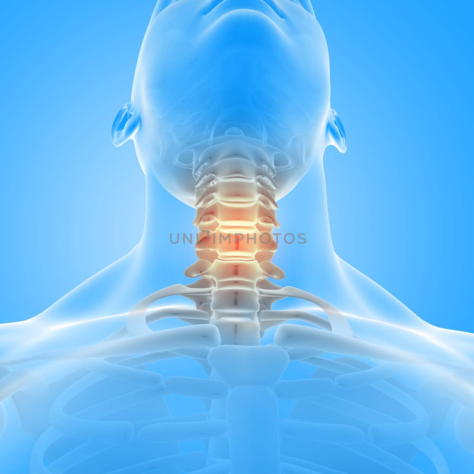 3D render of a male medical figure with neck bones highlighted