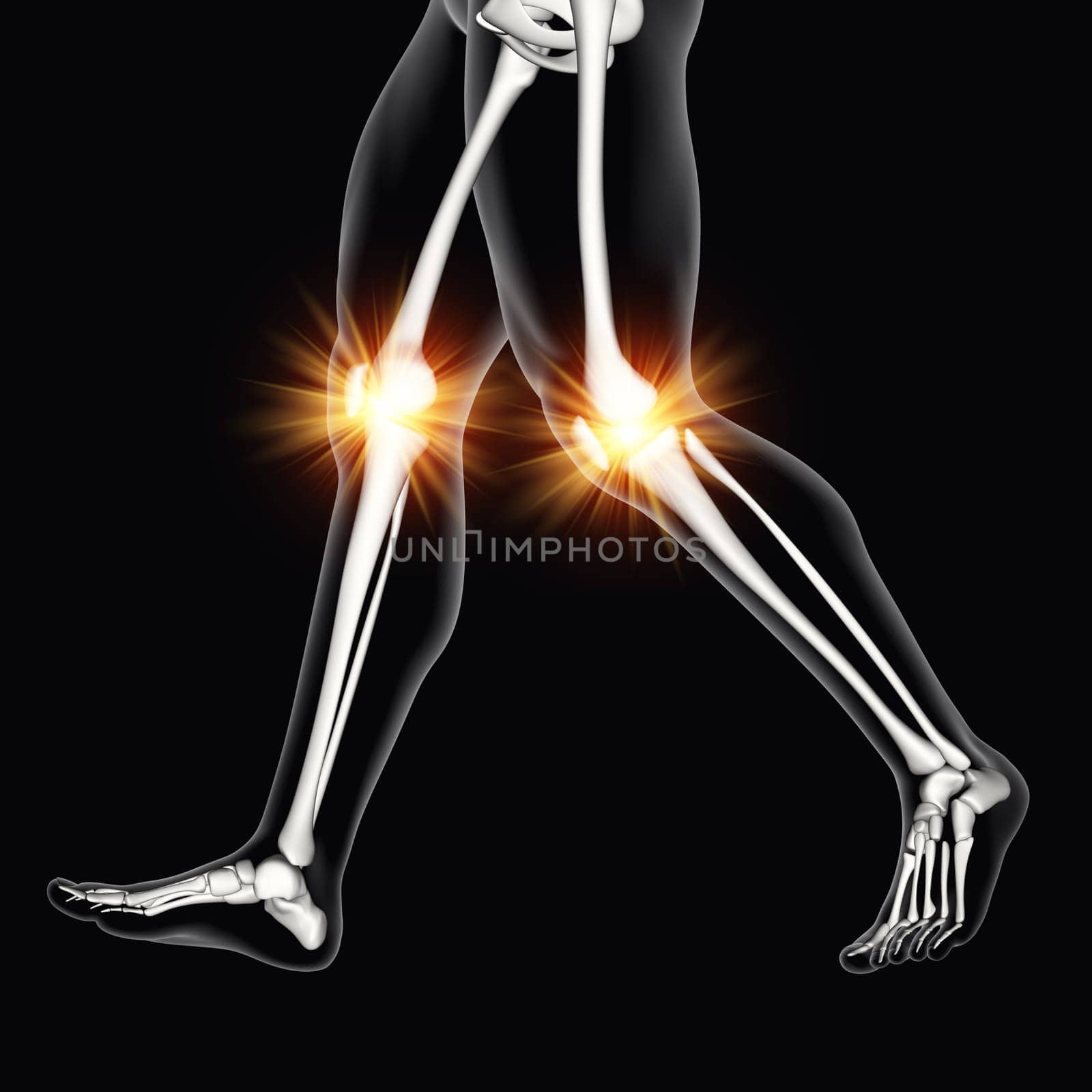3D render of a male medical figure with knee bones highlighted