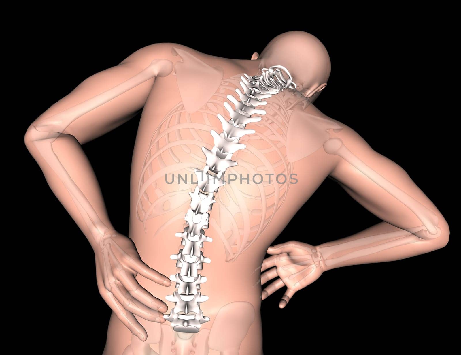 3D render of a male medical figure with spine highlighted