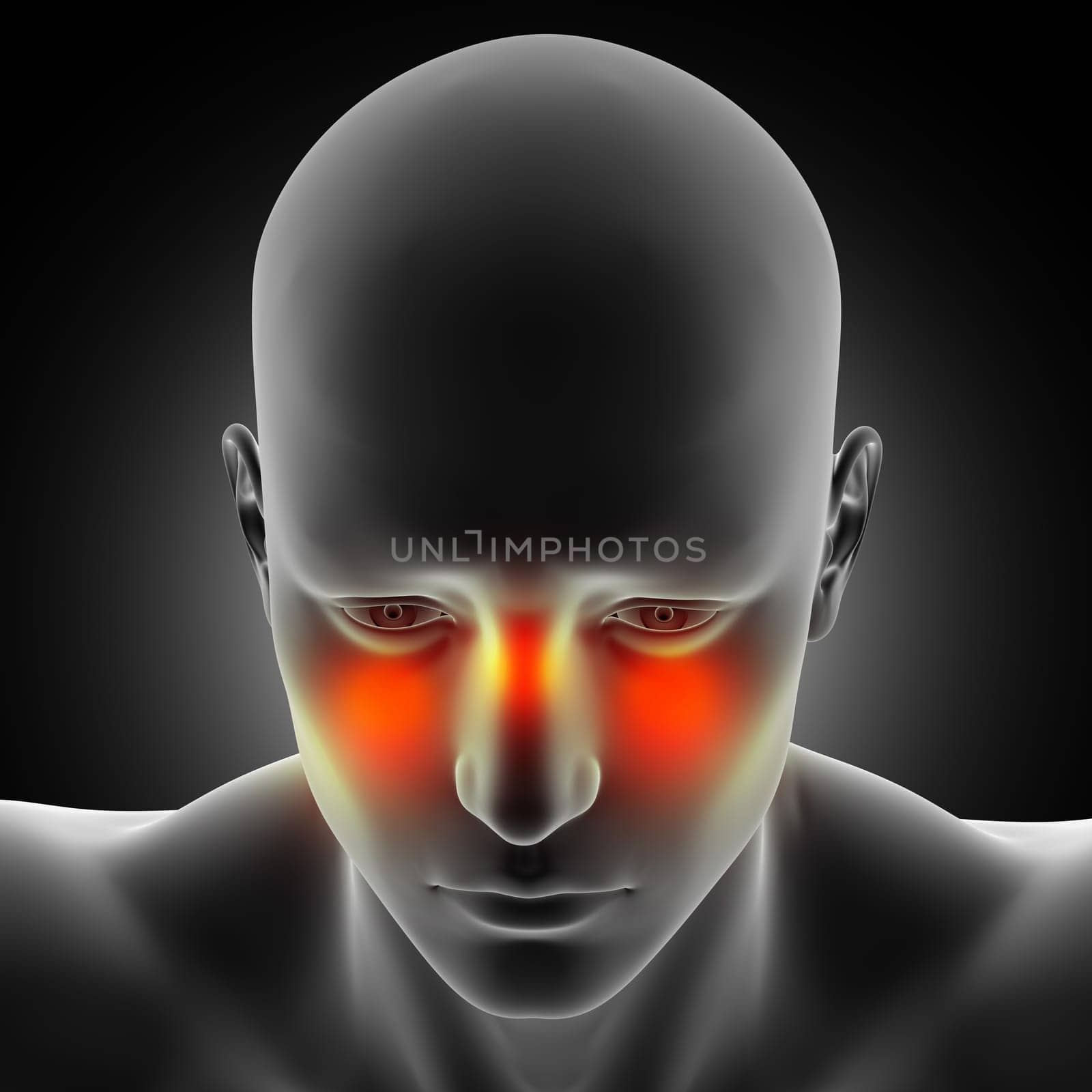 3D render of a male medical figure with sinus pain highlighted