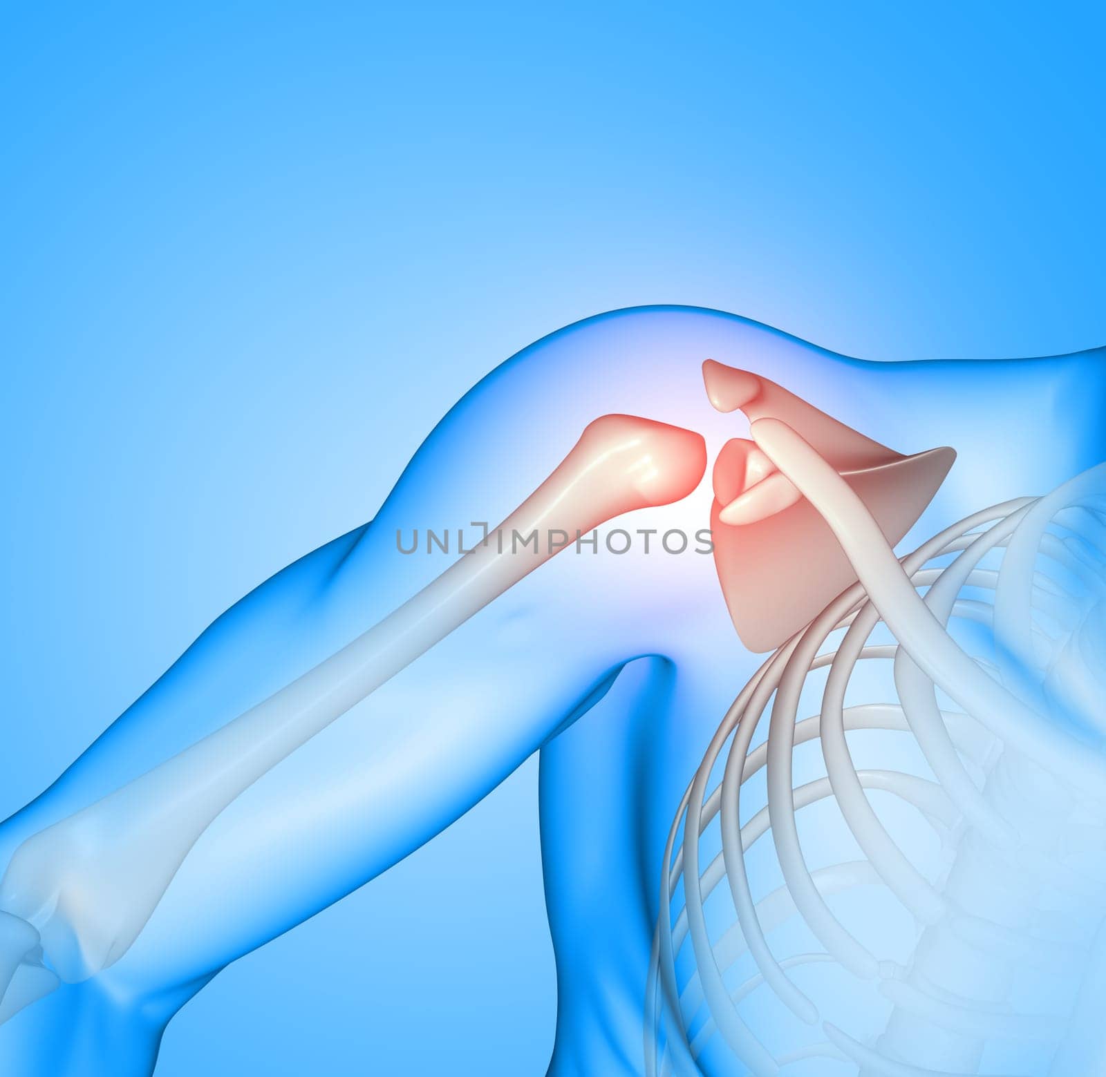 3D render of a male medical figure with shoulder socket highlighted