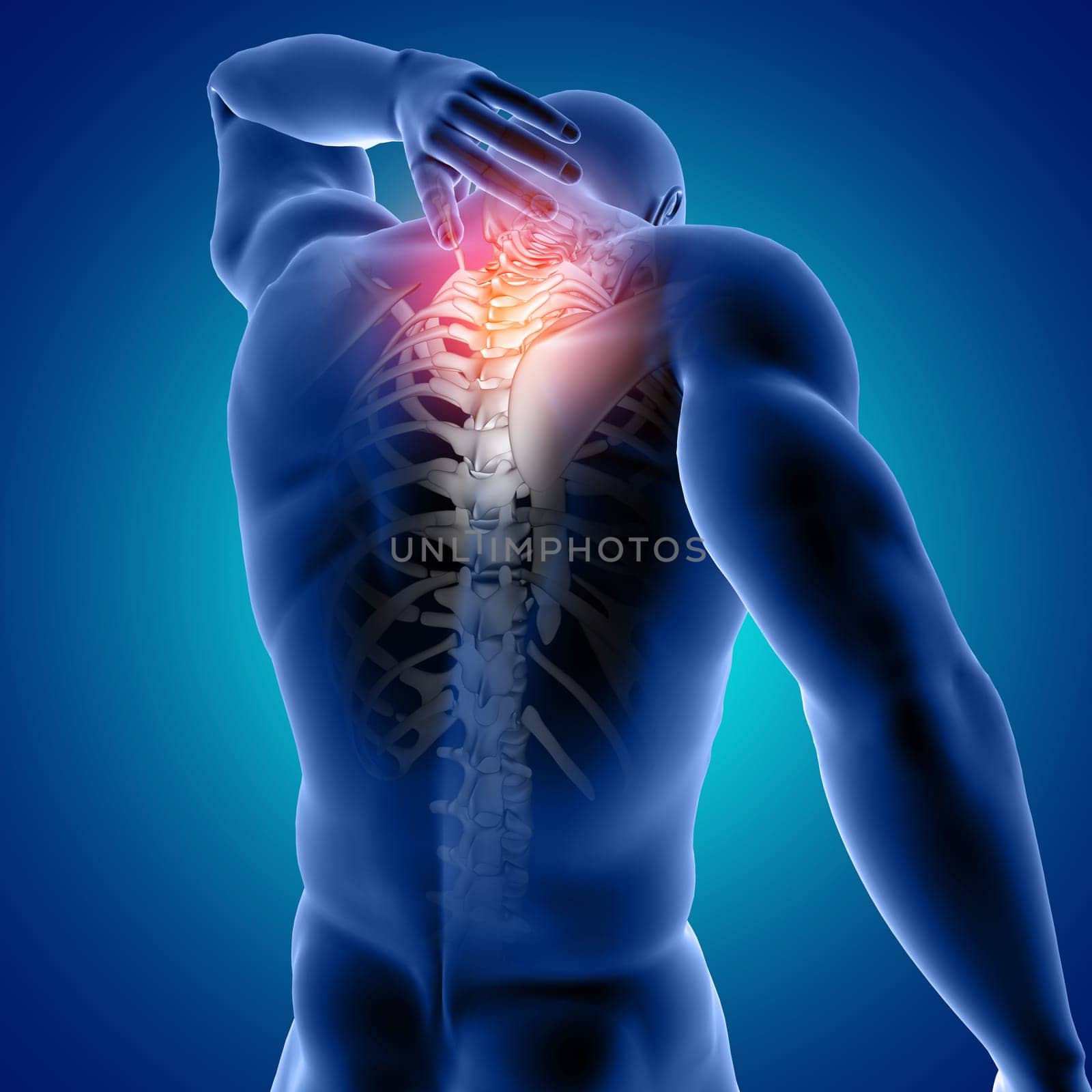 3D render of a male medical figure with top of spine highlighted