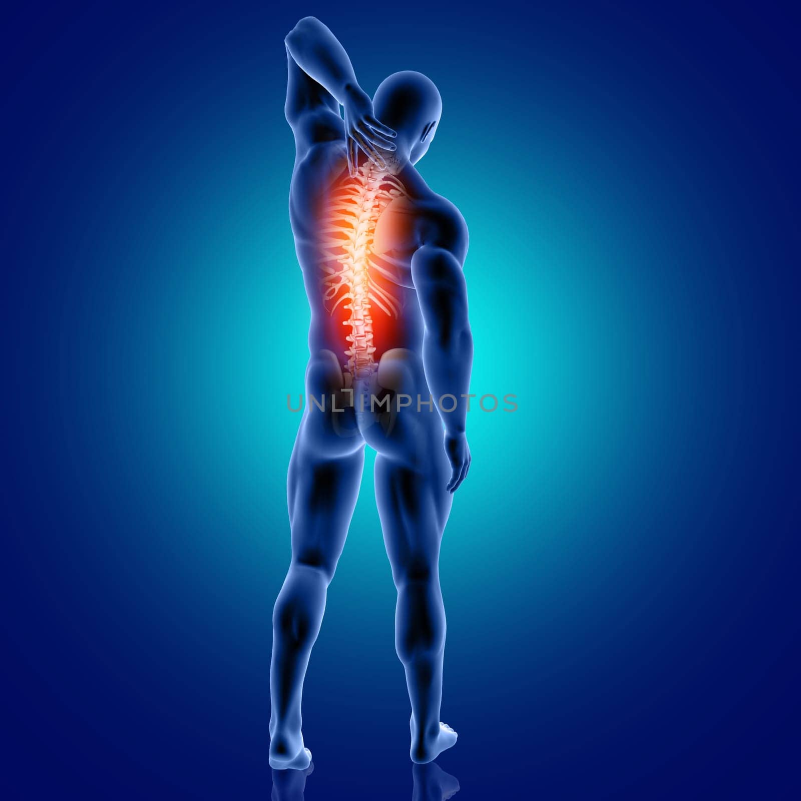3D render of a male medical figure with spine highlighted