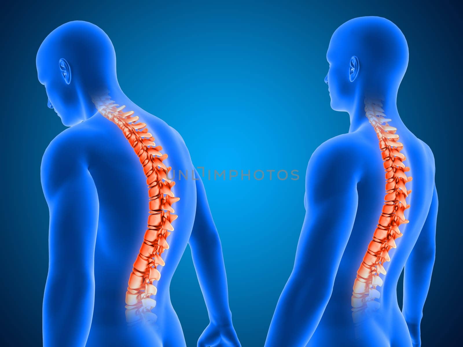 3D render of a medical background showing correct and poor posture with spine highlighted