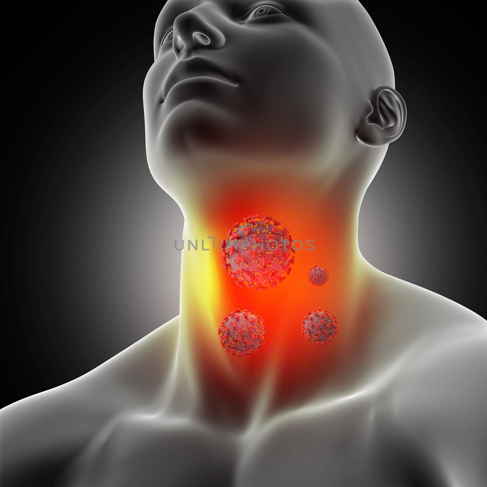 3D render of a male medical figure with sore throat and corona virus cells