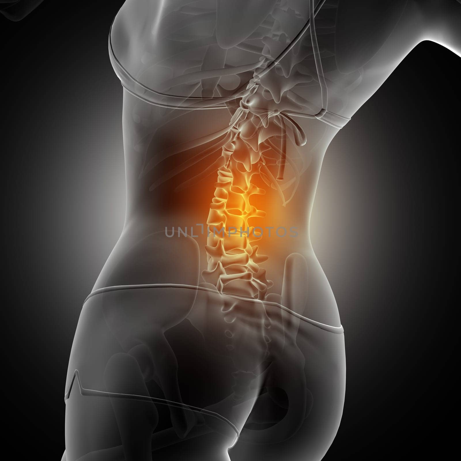 3D render of a medical background of a female figure with spine highlighted