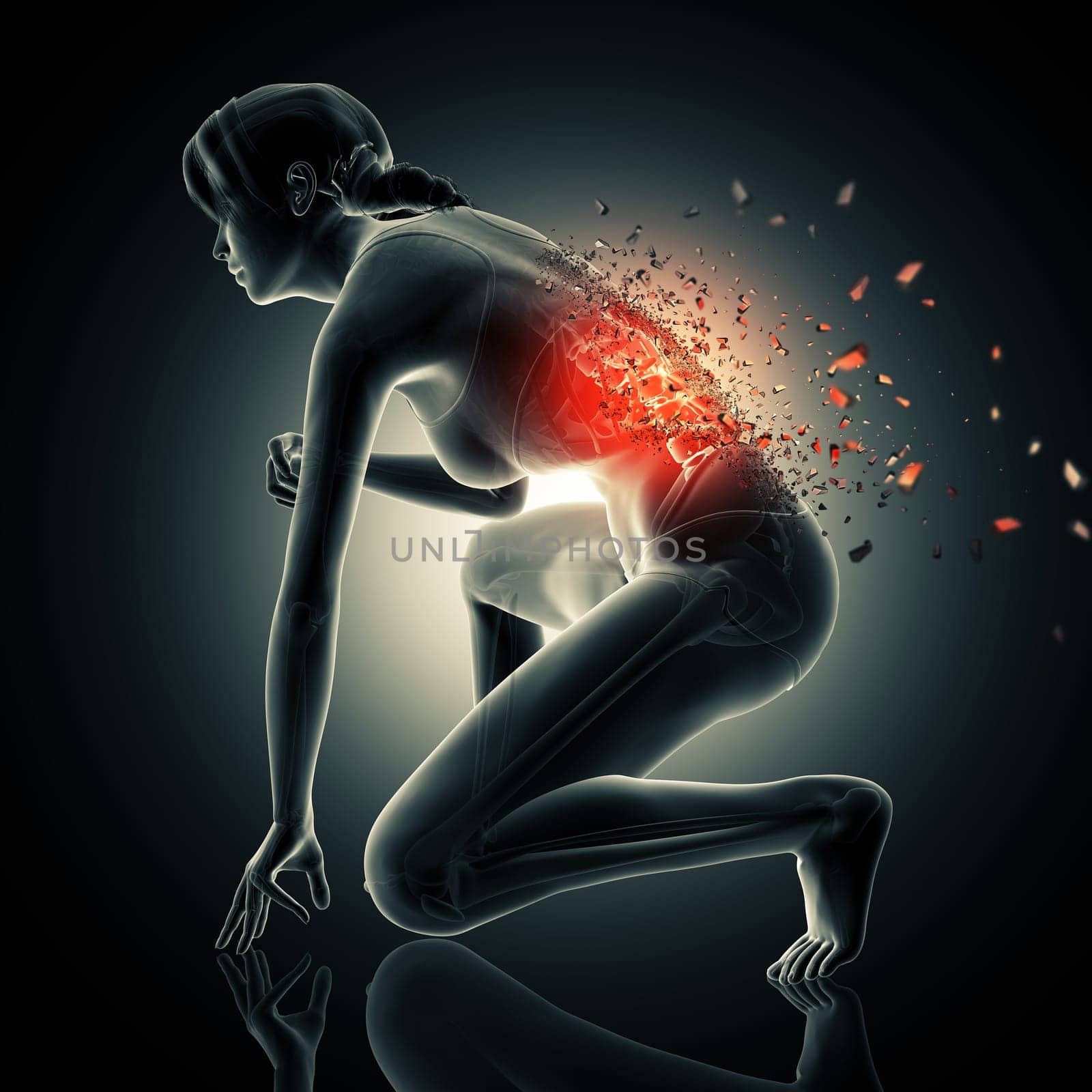 3D render of a medical background with female showing shatter effect on spine
