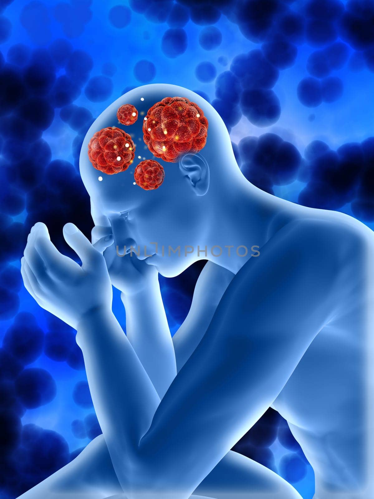 3D render of a medical background with male figure showing virus cells in head