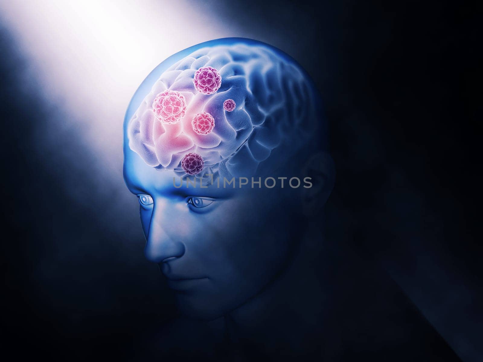 3D render of a medical background with virus cells on brain highlighted