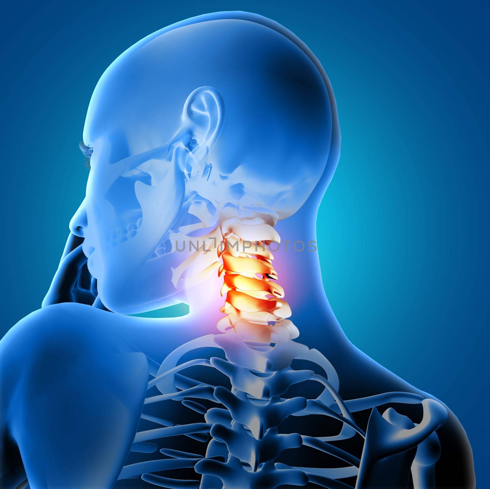 3D render of a medical female with neck bones highlighted