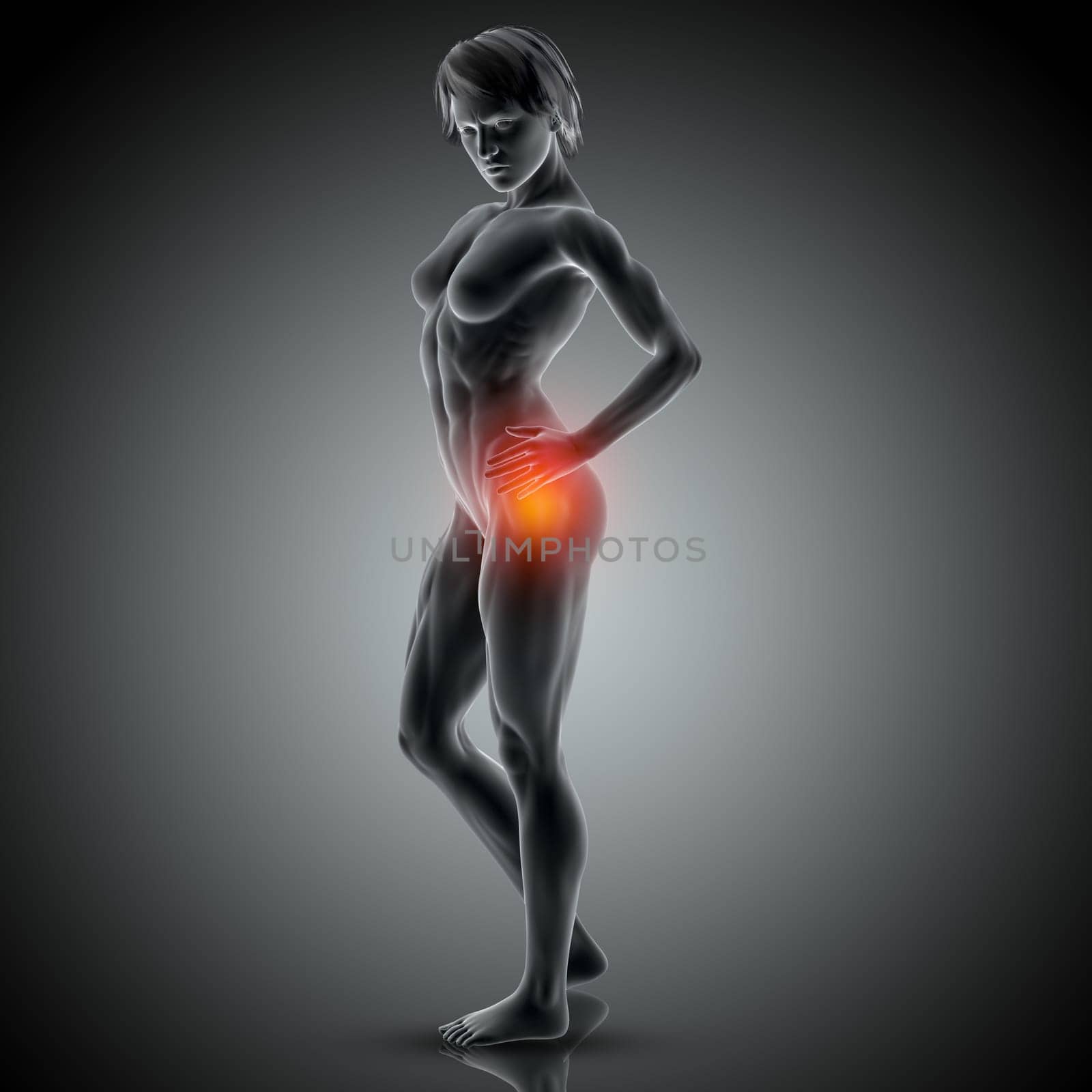 3D render of a medical image of female holding her hip in pain
