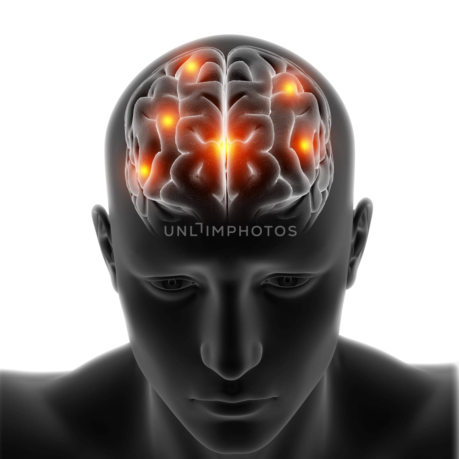 3D render of a medical figure with brain highlighted on white background