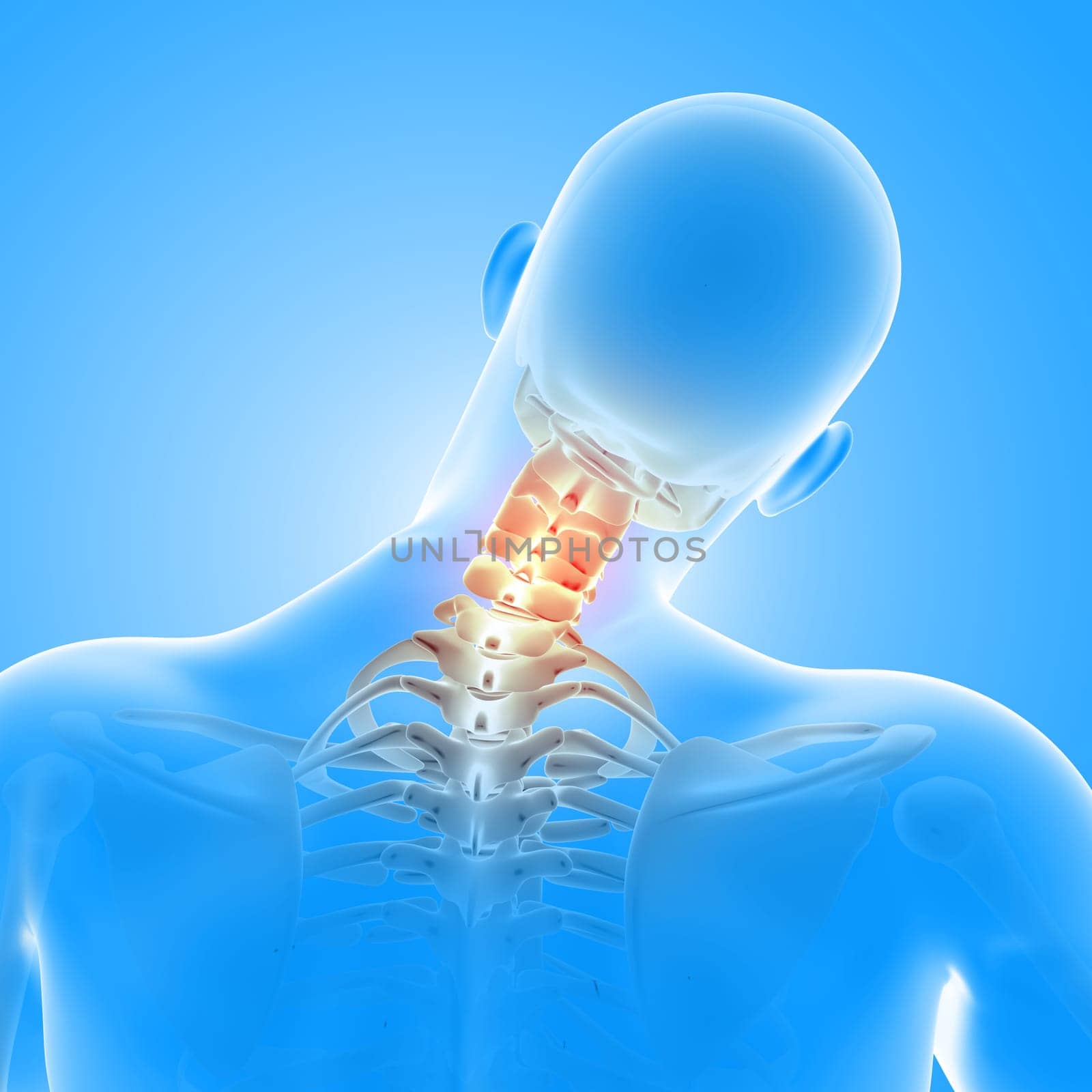 3D render of a medical male figure with neck bones highlighted