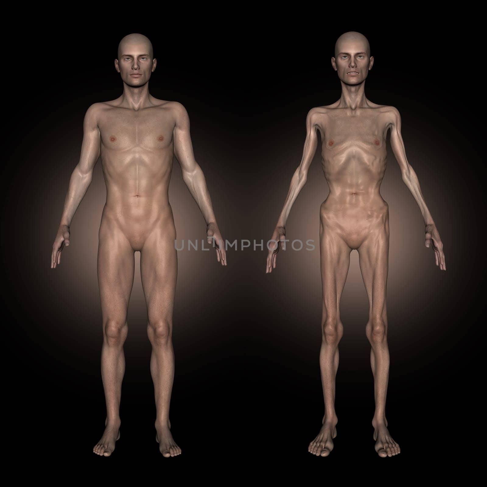 3D render of a medical image showing male at healthy and unhealthy weight