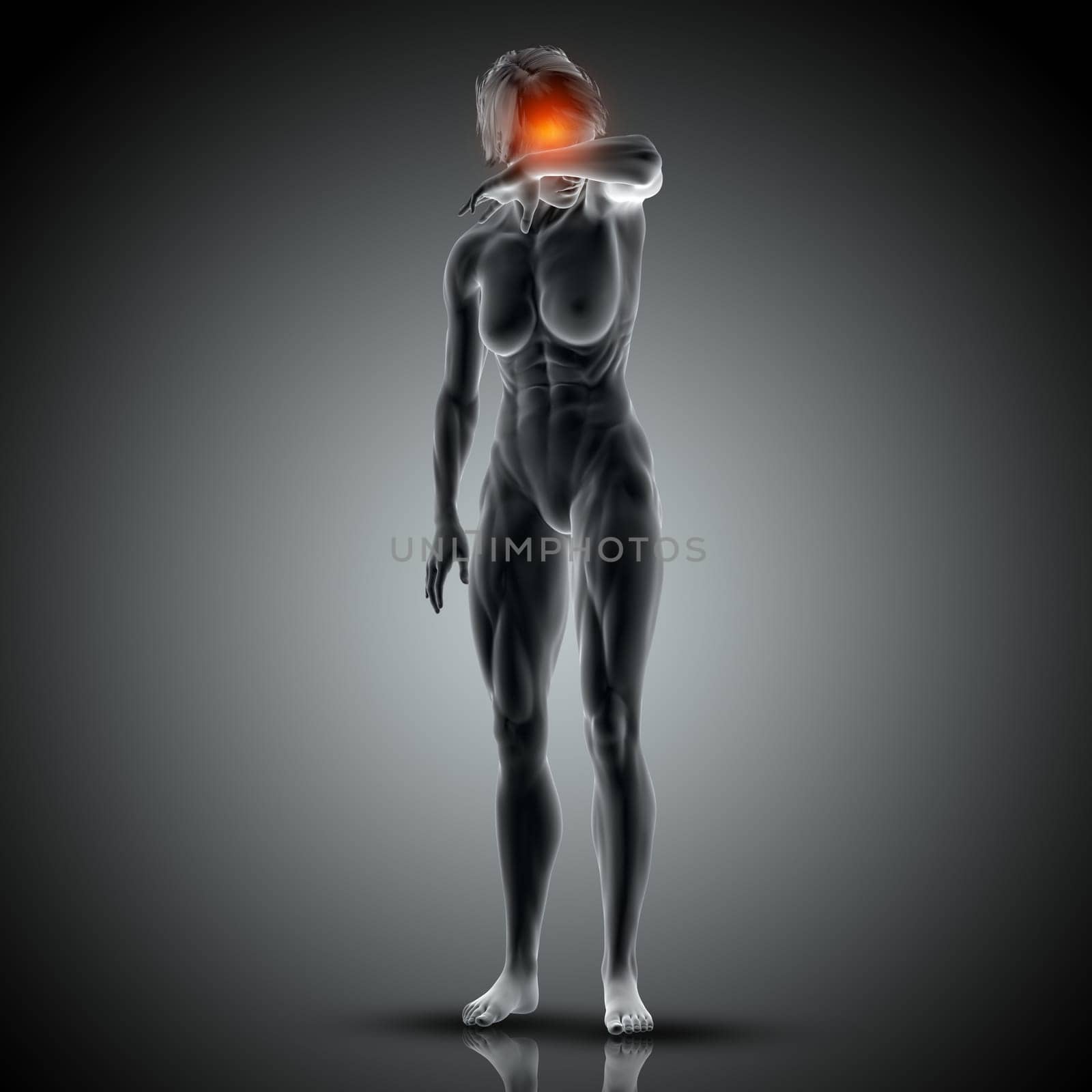 3D render of a medical image with female figure with head pain highlighted
