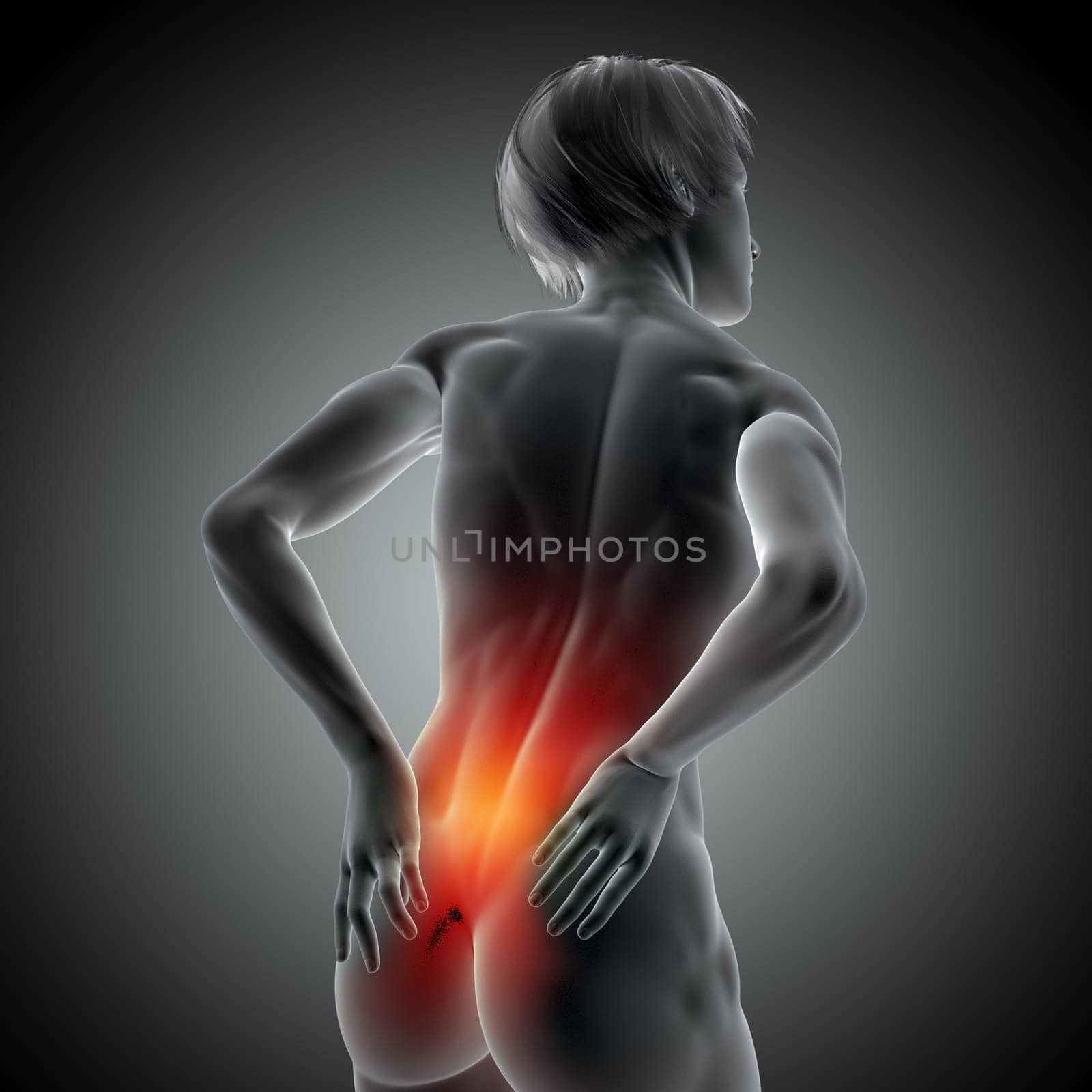 3D render of a medical image with female holding her back in pain