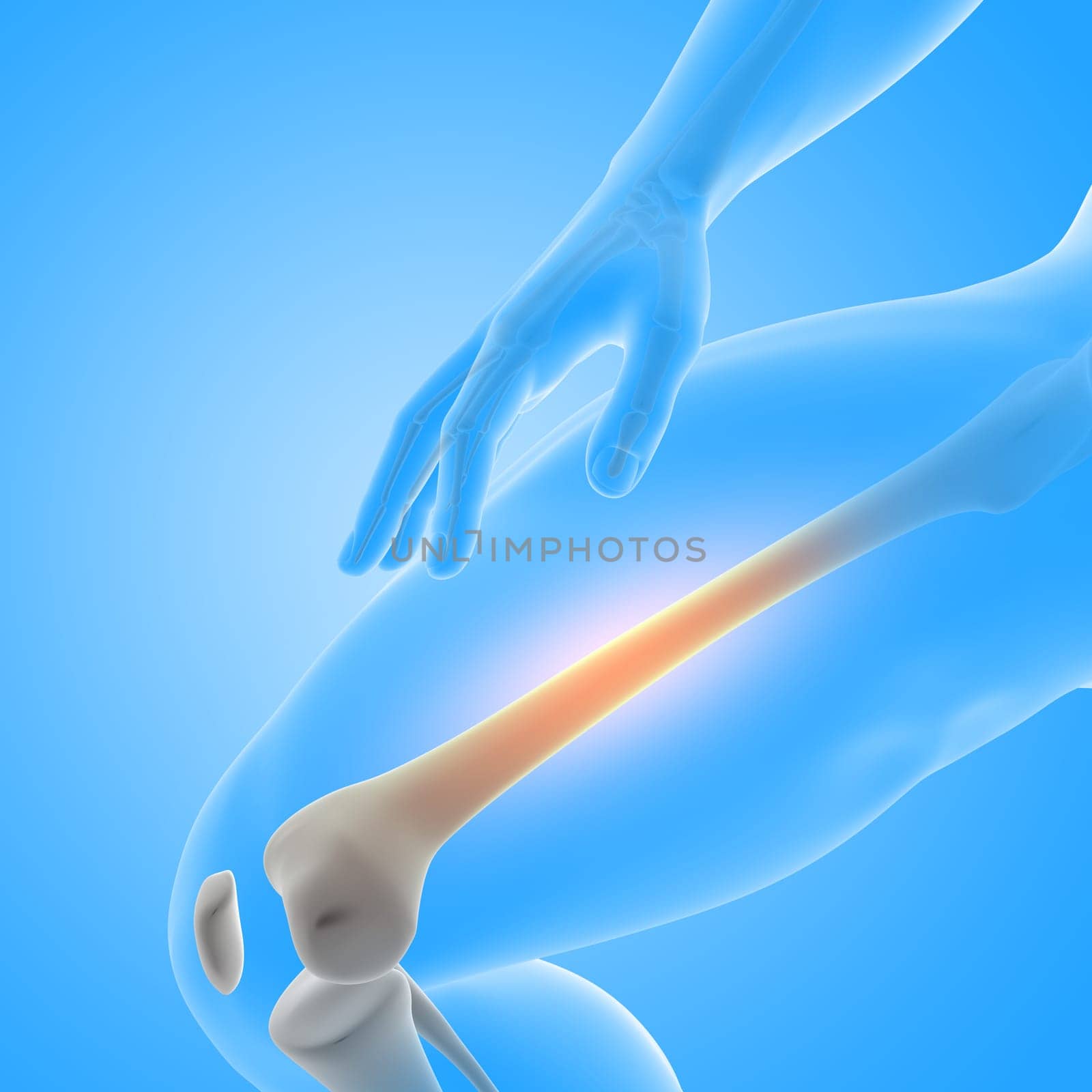 3D render of a medical male figure with close up of thigh bone