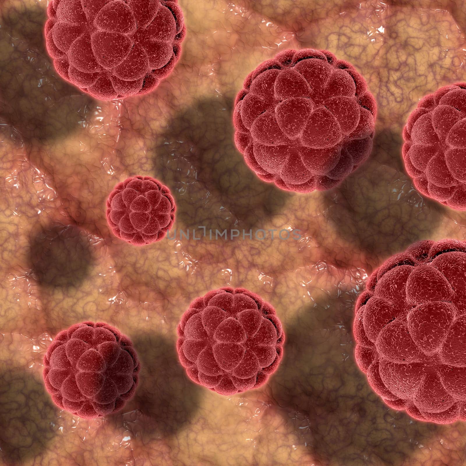 3D render of virus cells on a skin like texture