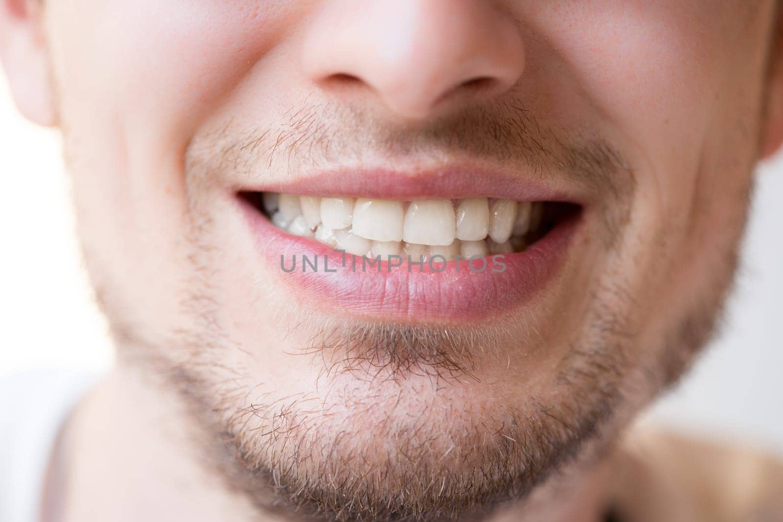 Young man with white teeth, red lips and a beard is smiling