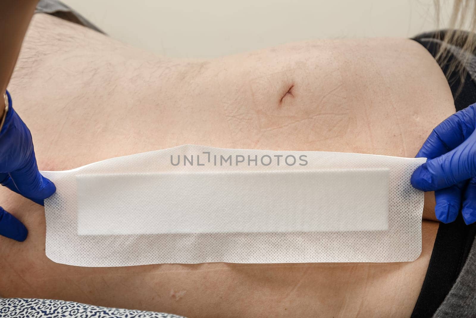 The nurse's hands apply a patch to the postoperative suture during a routine dressing.