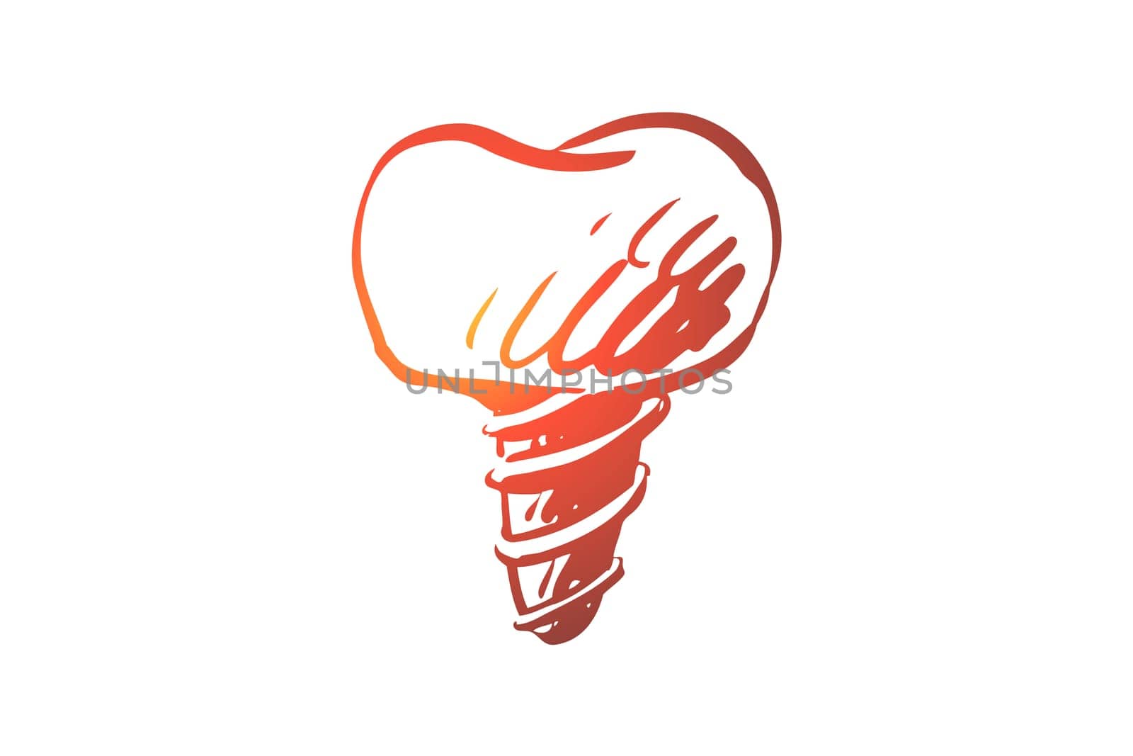 Dental, implant, tooth, health, stomatology concept. Hand drawn teeth implant, dentistry concept sketch. Isolated vector illustration.