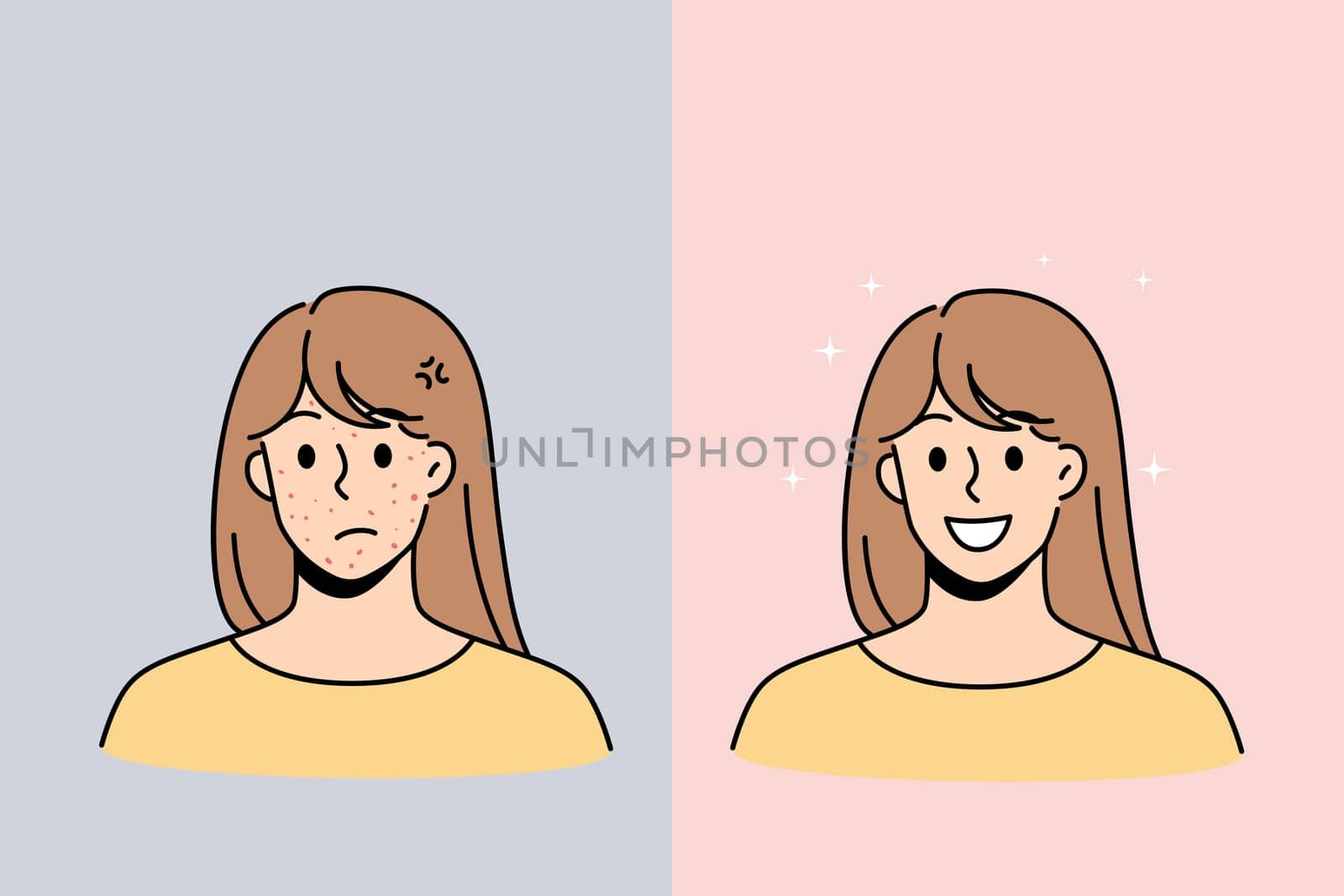 Skin problem and health concept. Stressed unhappy young woman with red acne pimples and smiling with healthy skin face vector illustration