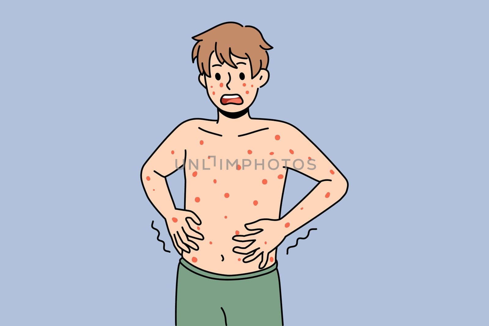 Unhealthy boy with red spots on body suffer from measles or rubella. Anxious unwell man struggle with rash fever, have severe symptoms. Healthcare concept. Flat vector illustration.