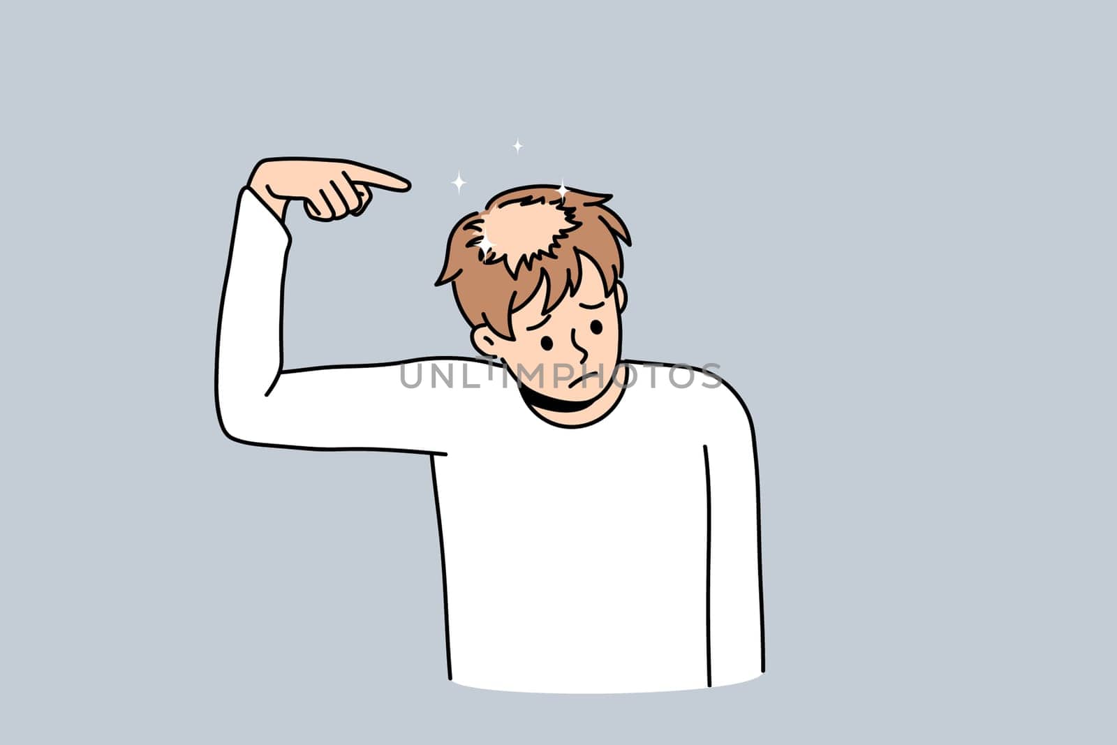 Unhappy young man point at bald head suffer from alopecia problems. Upset stressed guy struggle with hair loss need medical treatment. Haircare and aging concept. Flat vector illustration.