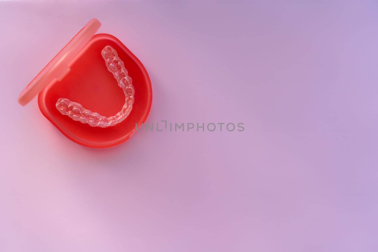 Orthodontological individual aligner for bite correction.