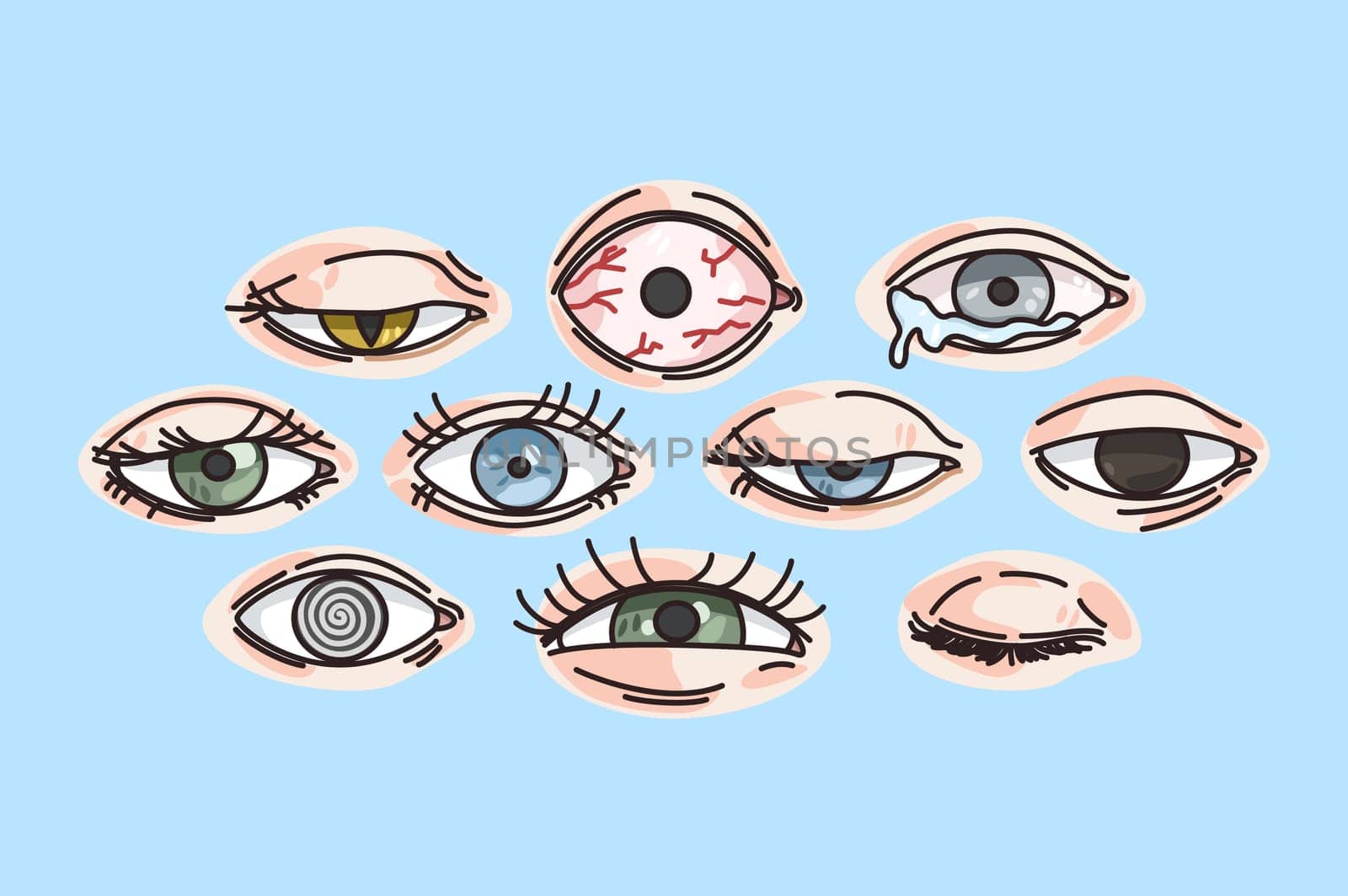 Set of different eyes disease. Collection of icons of various eyesight sickness or illness. Ophthalmology care. Sight problem. Medicine and healthcare. Vector illustration.