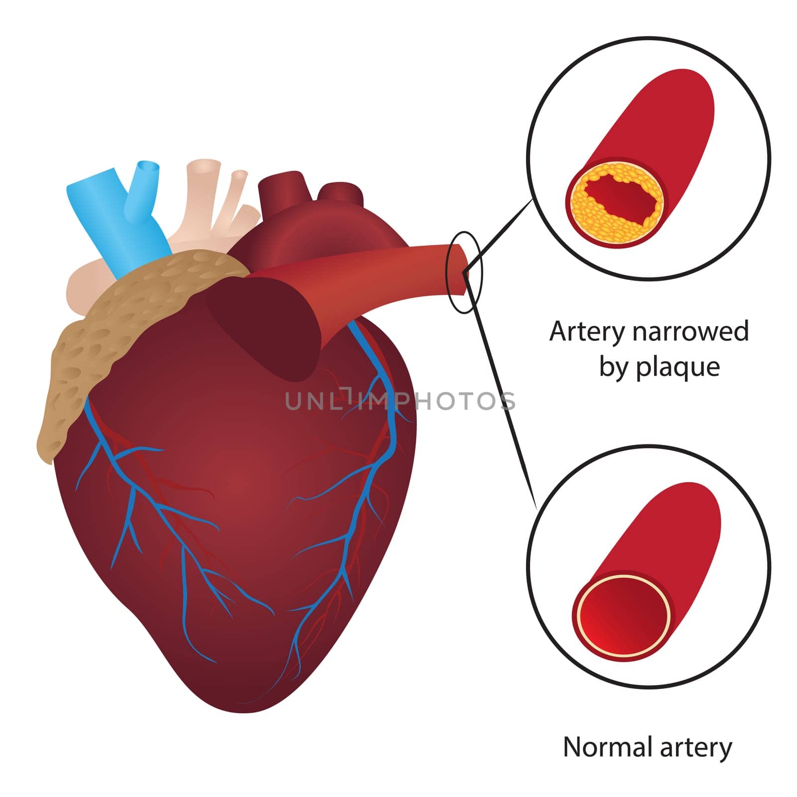 Cholesterol level in blood vessel vector illustration