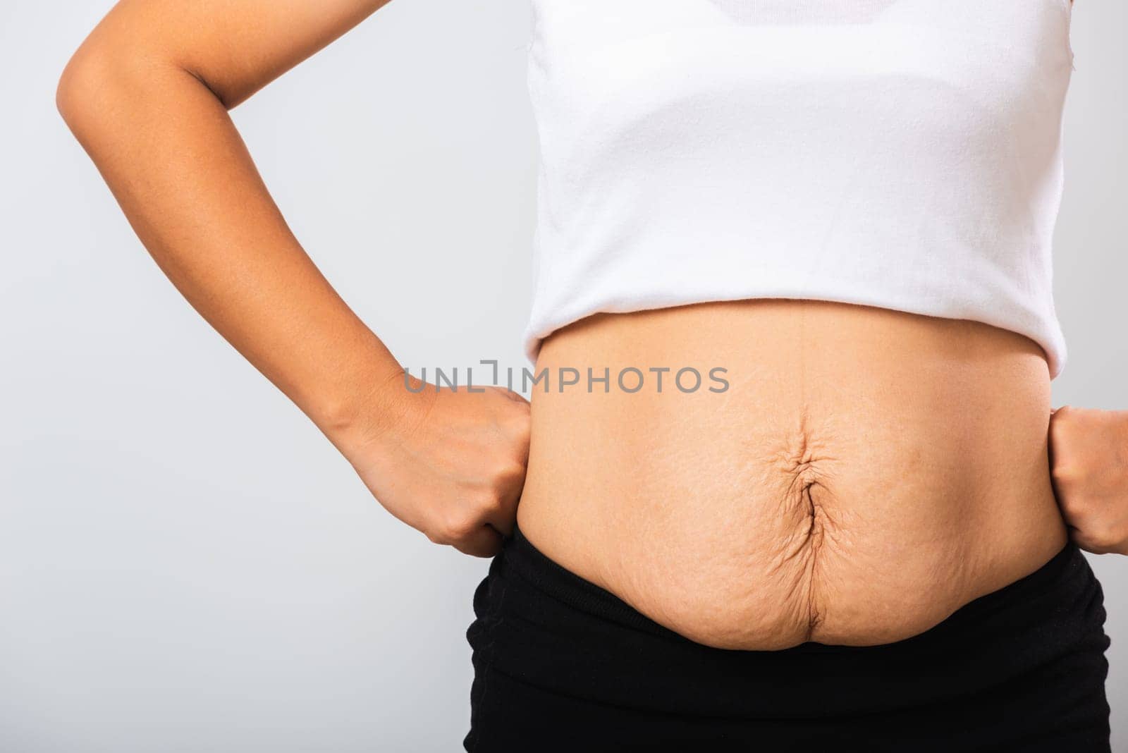 Close up of Asian mother woman showing stretch mark loose lower abdomen skin she fat after pregnancy baby birth, studio isolated on white background, Healthy belly overweight excess body concept