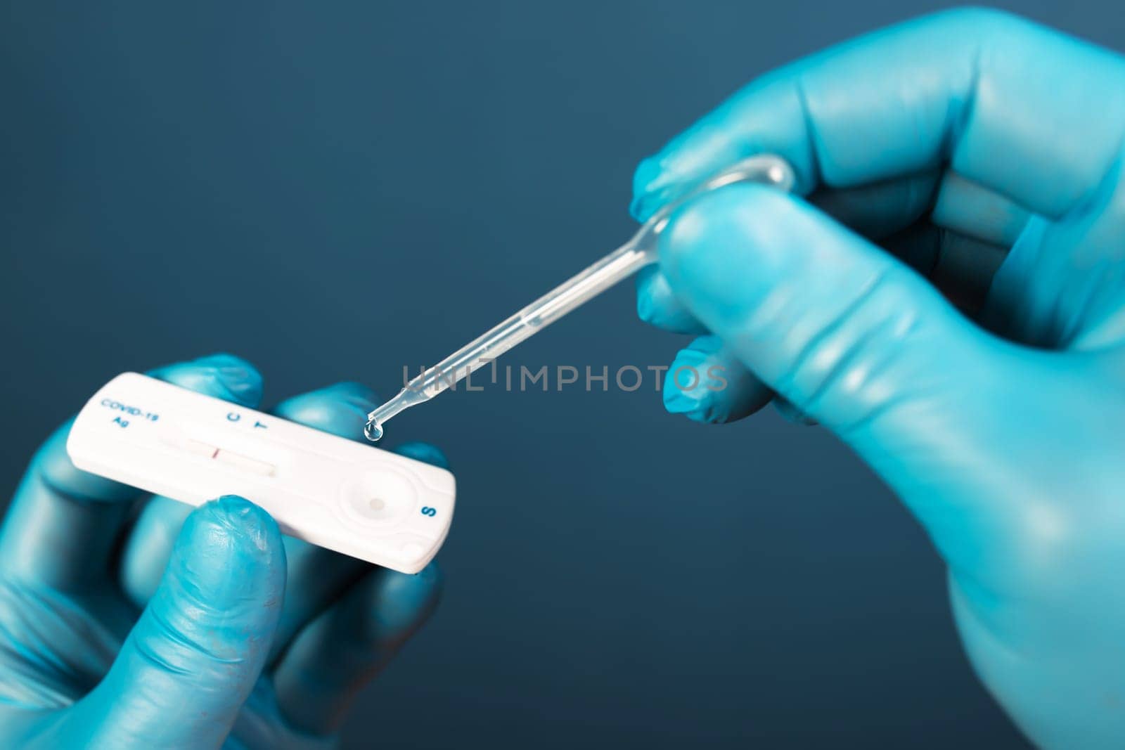 Medical healthcare holding COVID-19, coronavirus swab collection kit, wearing protective gloves