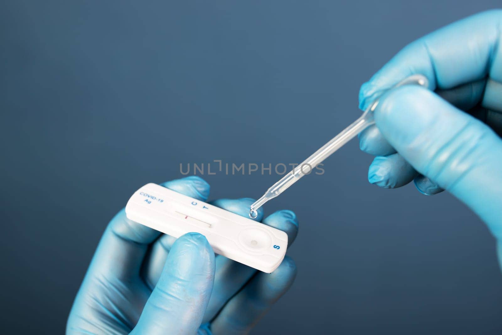 Medical healthcare holding COVID-19, coronavirus swab collection kit, wearing protective gloves