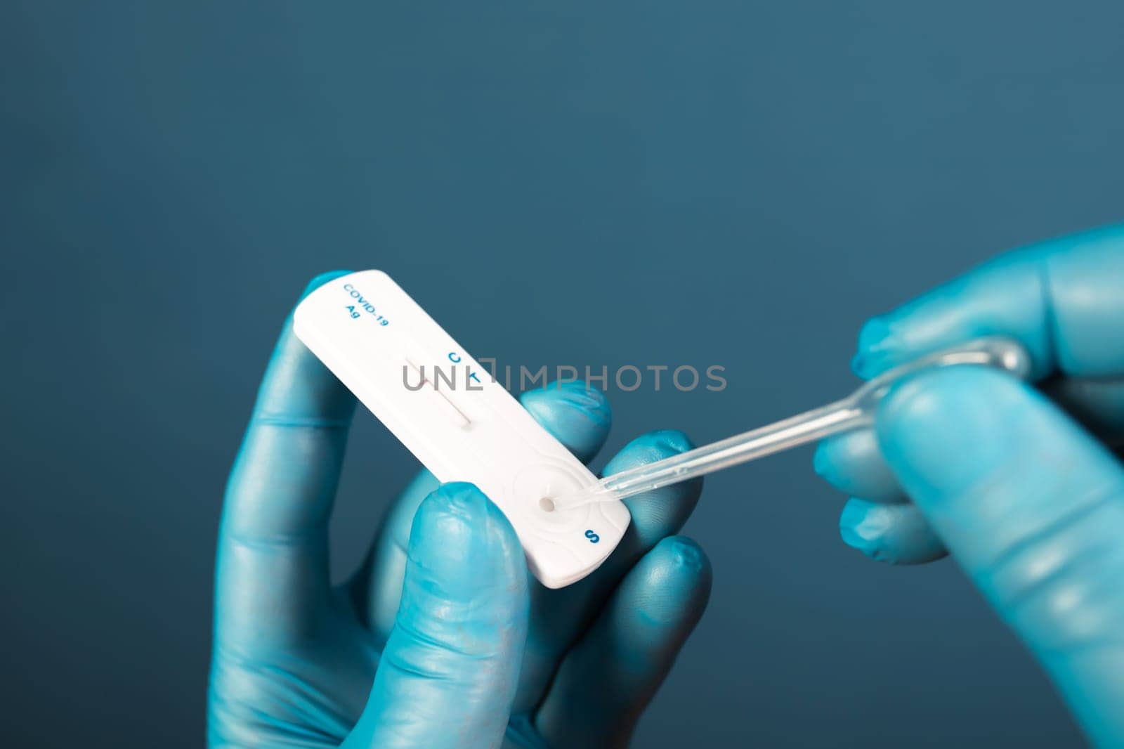 Medical healthcare holding COVID-19, coronavirus swab collection kit, wearing protective gloves