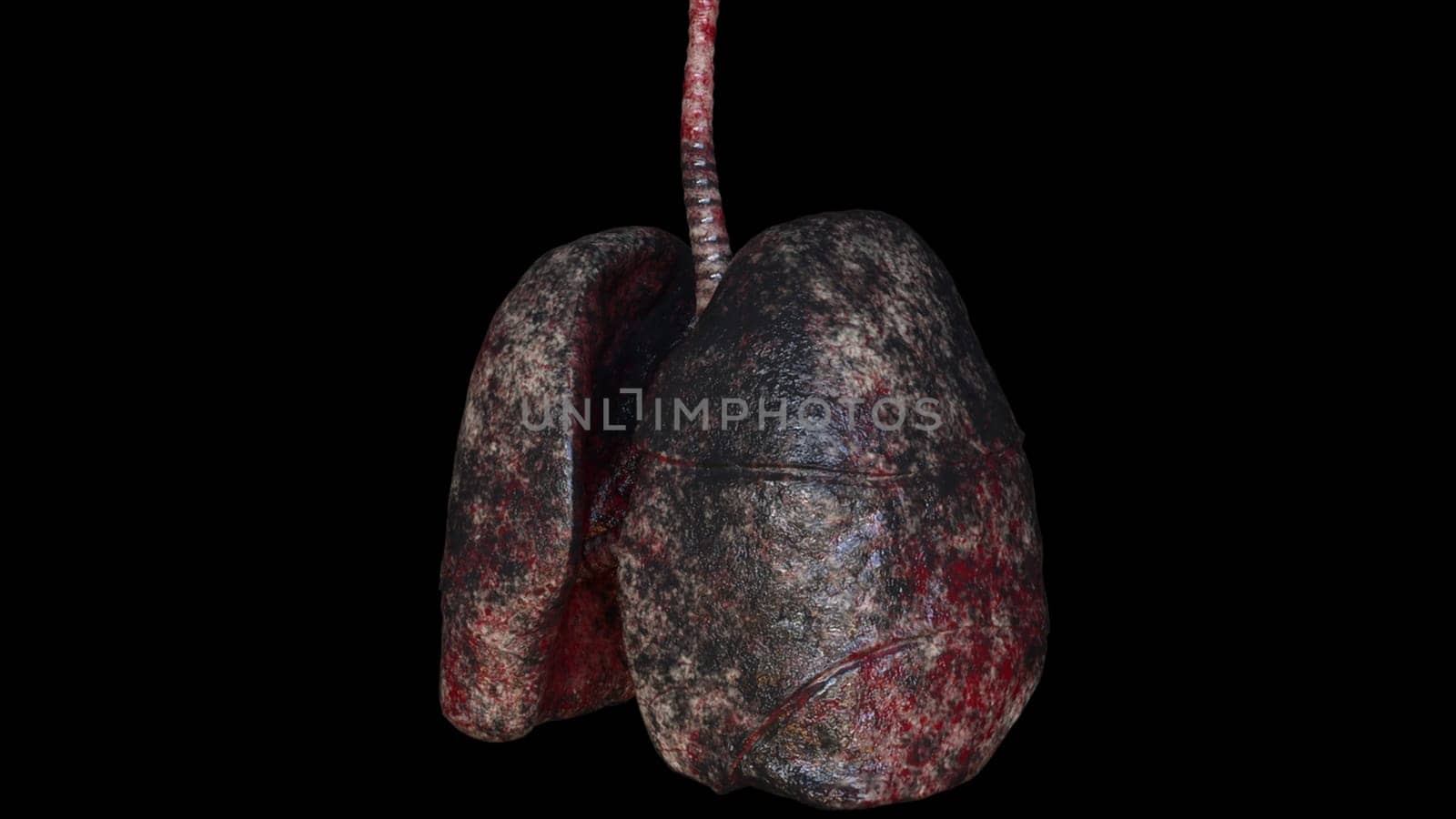 Respiratory organs darkened from resins with 3d render unhealthy spots. Anatomical trachea affected by cancer with diseased pleura leaking viruses. Bad habit symbol with realistic design.