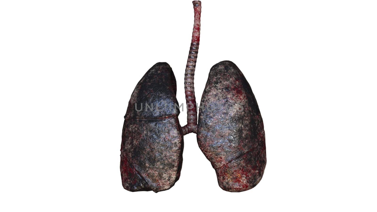 Respiratory organs darkened from resins with 3d render unhealthy spots. Anatomical trachea affected by cancer with diseased pleura leaking viruses. Bad habit symbol with realistic design.