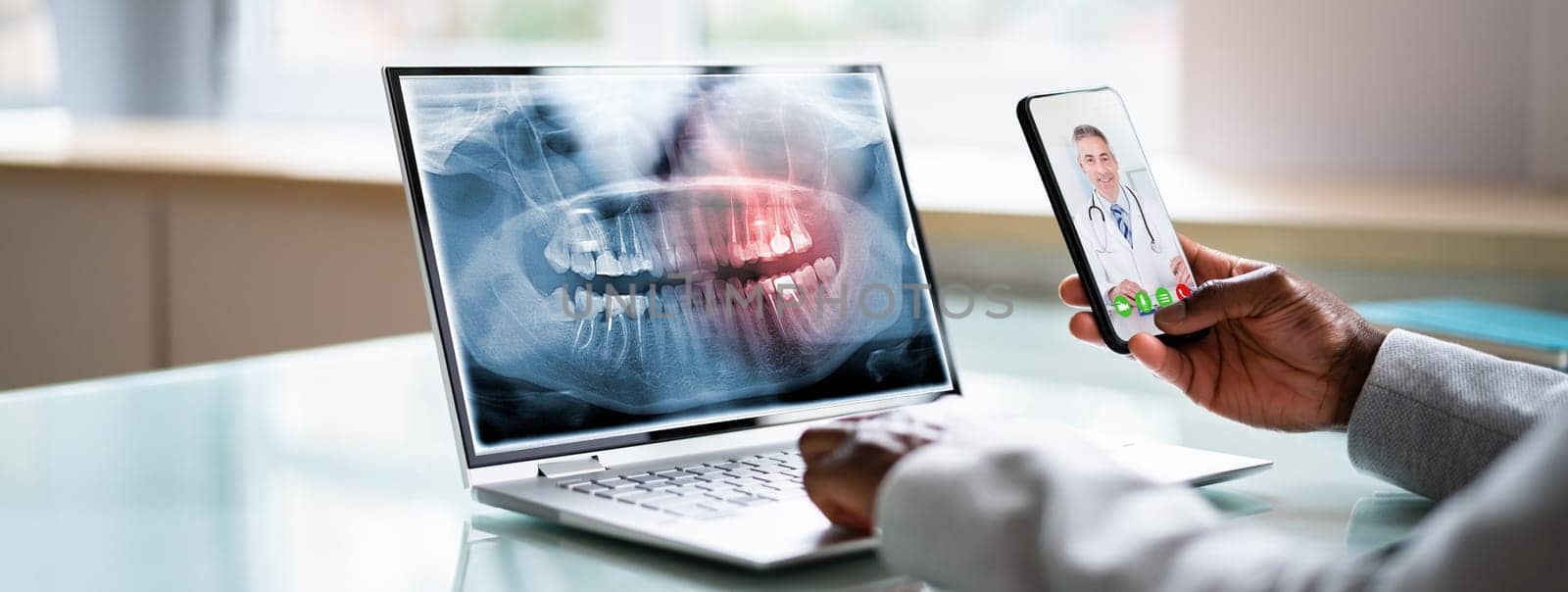 Medical Doctor Online Video Call With Dentist